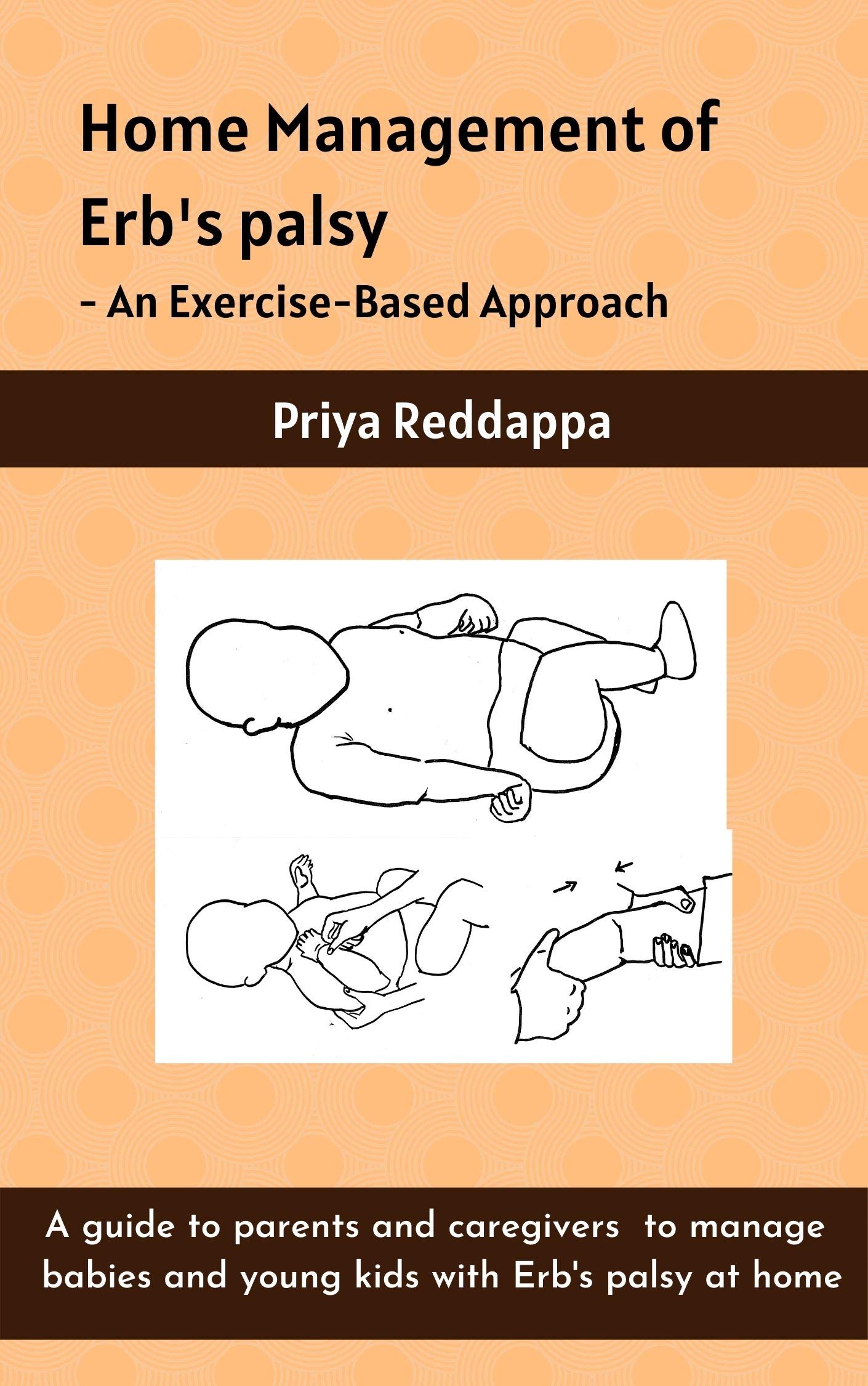 Home Management of Erb's Palsy - An Exercise-Based Approach: A guide to parents and caregivers to manage babies and young kids with Erb's palsy at home