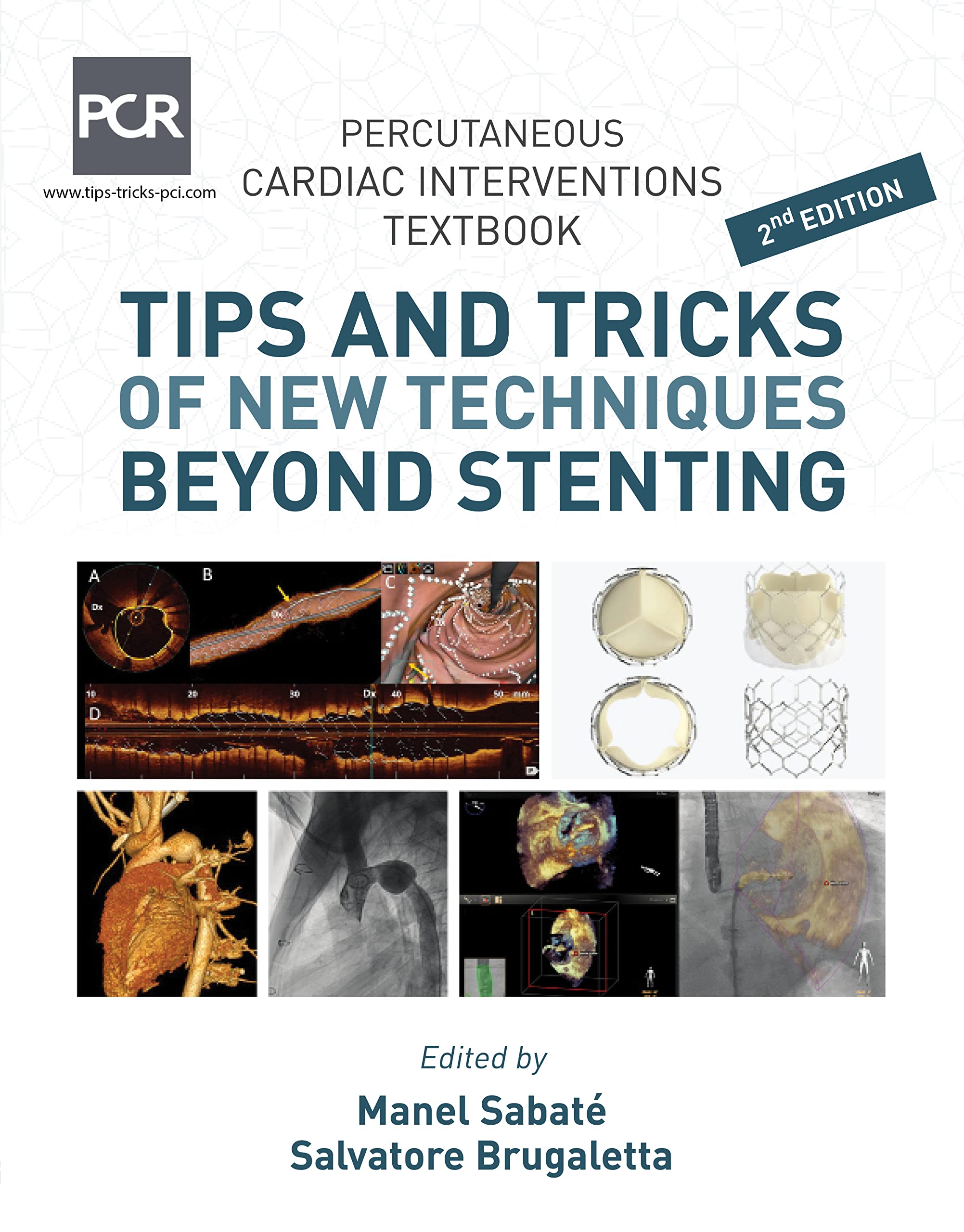 Percutaneous Cardiac Intervention Textbook- Tips and Tricks of New Techniques Beyond Stenting