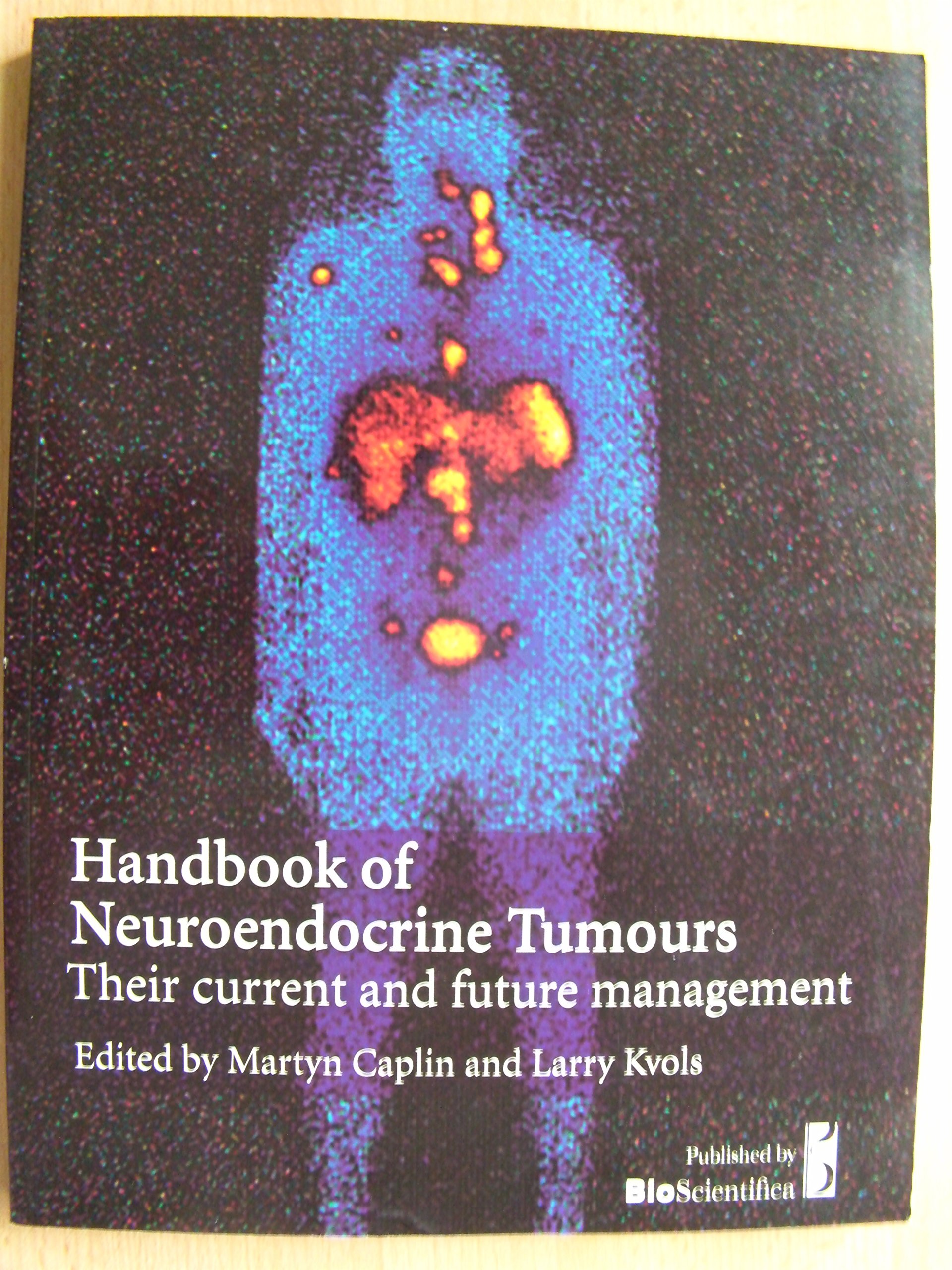 Neuroendocrine tumors a guide for physicians. Ed. Caplin M. / Neyroendokrinnye opukholi rukovodstvo dlya vrachey. Pod red. Keplin M.,