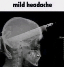 an x-ray of a person 's head with a knife sticking out of it ..