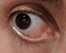 a close up of a person 's eye with a red spot in it