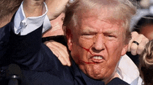 a man with blood on his face is being held by a crowd