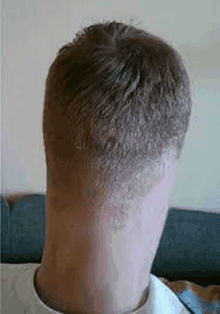 the back of a man 's head with a very short haircut and a very long neck .