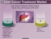 liver cancer treatment market trends size and forecast 2018-2023