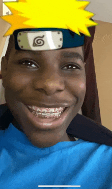 a young man with braces on his teeth is wearing a headband with a g on it