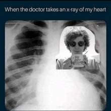 an x-ray of a person 's heart with the caption when the doctor takes an x-ray of my heart ..