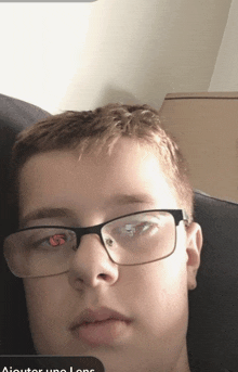 a young boy wearing glasses has a red eye on his left eye