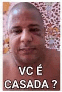 a shirtless man with a black eye and the words `` vc e casada '' written on his face .