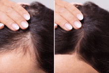 a woman 's hair is shown before and after a treatment