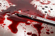 a knife is laying on a bloody surface on a table .