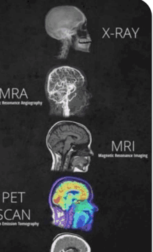 a poster showing different types of brain scans