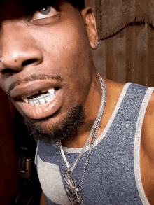 a man with braces on his teeth is wearing a gray tank top