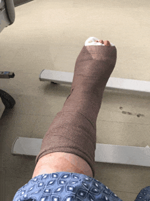 a person 's leg is wrapped in a cast and bandage