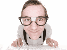 a man with glasses and a bandage on his nose is typing on a white keyboard