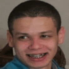 a close up of a young man with braces on his teeth smiling .