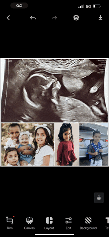 an ultrasound of a baby and a collage of pictures of children