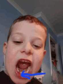 a boy with his mouth open and a blue arrow pointing to his teeth