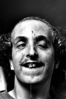 a black and white photo of a man 's face with a tooth missing