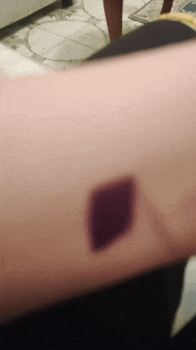 a close up of a person 's arm with a purple spot on it