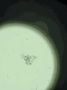 a microscope shows purple dots on a green background