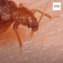 a close up of a bed bug on a person 's skin with an apex pest control logo