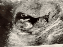 an ultrasound image of a baby with the words little peanut written on it