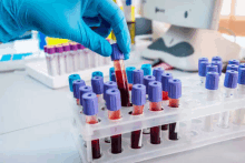 a hand in a blue glove holds a test tube of blood over a rack of test tubes