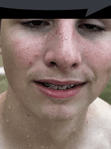 a close up of a person 's face with braces on