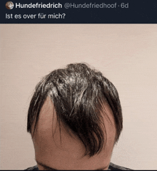 a picture of a man 's head with the caption " hundefriedrich @hundefriedhoof 6d ist es over für mich "