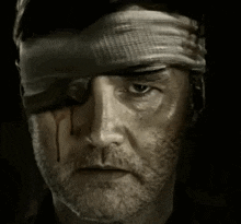 a man with a bandage on his head and a bloody eye is looking at the camera .