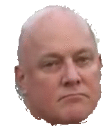 a bald man 's head is shown with a serious look on his face .