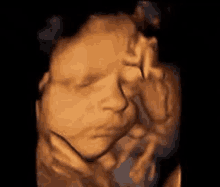 a 3d ultrasound of a baby 's face in the womb