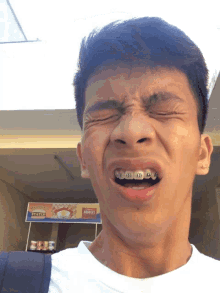 a young man with braces on his teeth making a funny face in front of a sign that says states