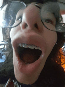 a woman with braces on her teeth is making a funny face with her mouth open