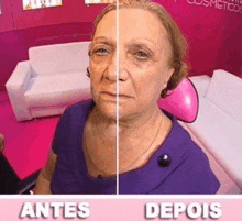 a woman is sitting in front of a pink couch and a before and after picture of her face .