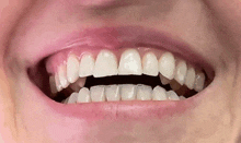 a close up of a person 's teeth with braces on