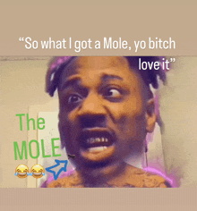 a meme of a man with the words " so what i got a mole yo bitch love it "