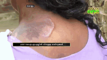 a woman 's neck is shown on a television screen with the letters media on it