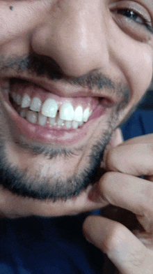 a close up of a man 's mouth with a missing tooth