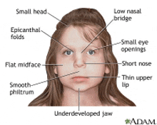 a diagram of a child 's face showing the various parts