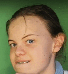 a young girl with braces on her teeth looks at the camera .