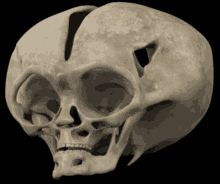 a close up of a human skull with a black background