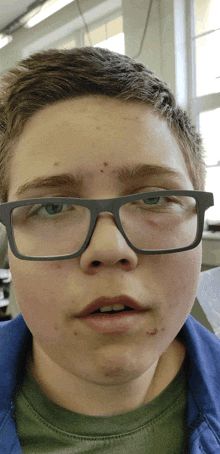 a boy wearing glasses looks at the camera with his mouth open