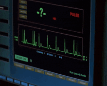 a monitor shows a pulse and a question mark on it