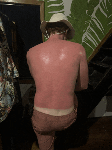 a man with a sunburned back is wearing a hat