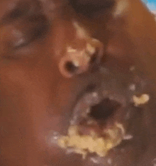 a close up of a person 's face with food in it .