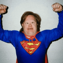 a man with down syndrome is dressed as superman and flexing his muscles