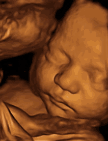 a 3d ultrasound of a baby 's face is shown in a close up .