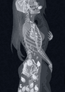 an x-ray of a woman 's skeleton with a gun and a clock