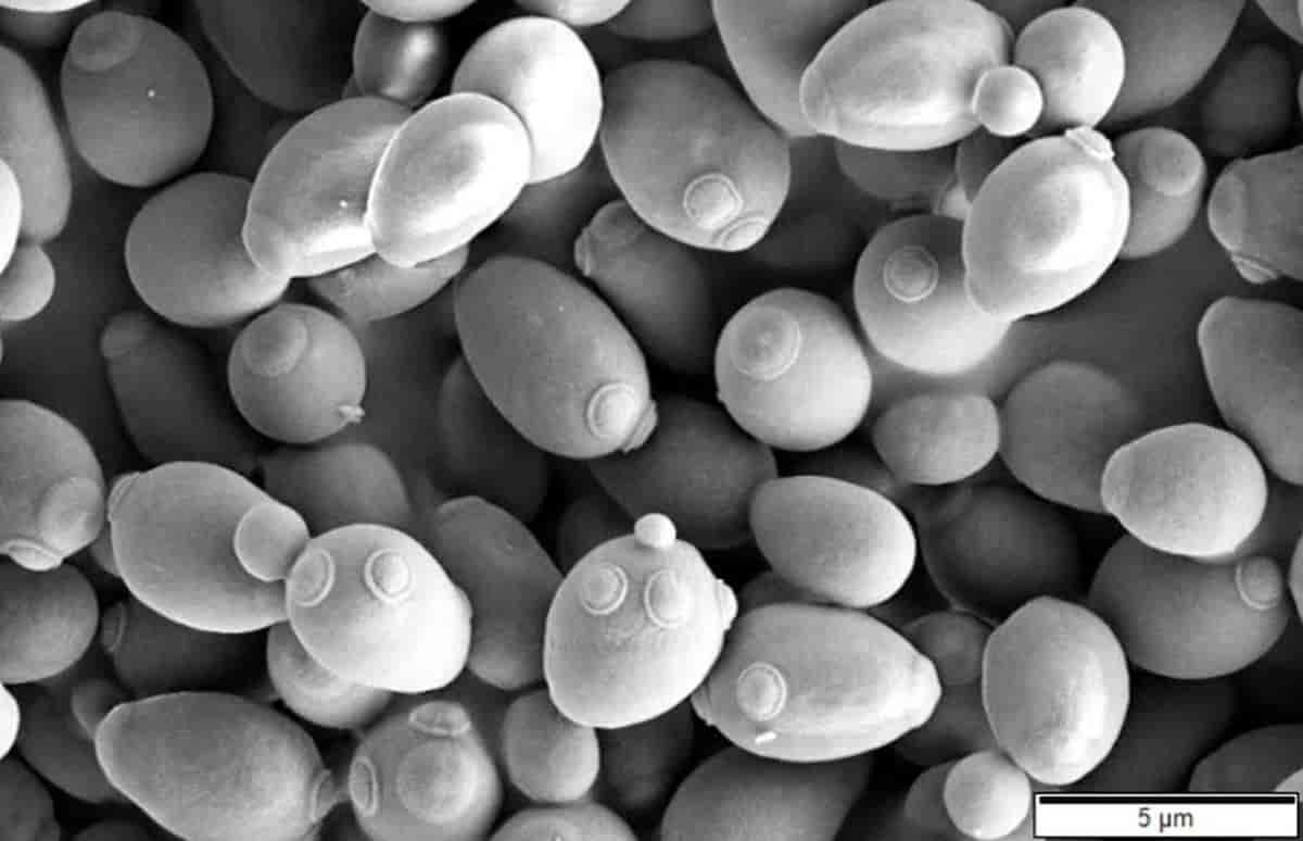 Saccharomyces cerevisiae SEM bilde